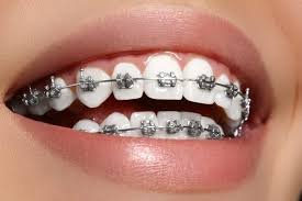 Orthodontics