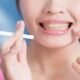 How to Remove Teeth Stains Caused by Smoking