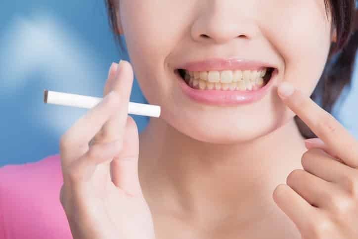 How to Remove Teeth Stains Caused by Smoking